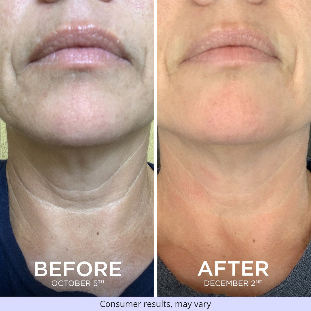 Sculpt & Lift Duo