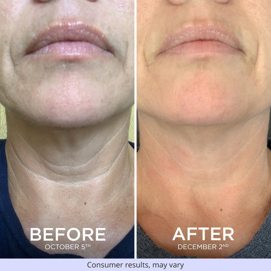 Sculpt & Lift Duo