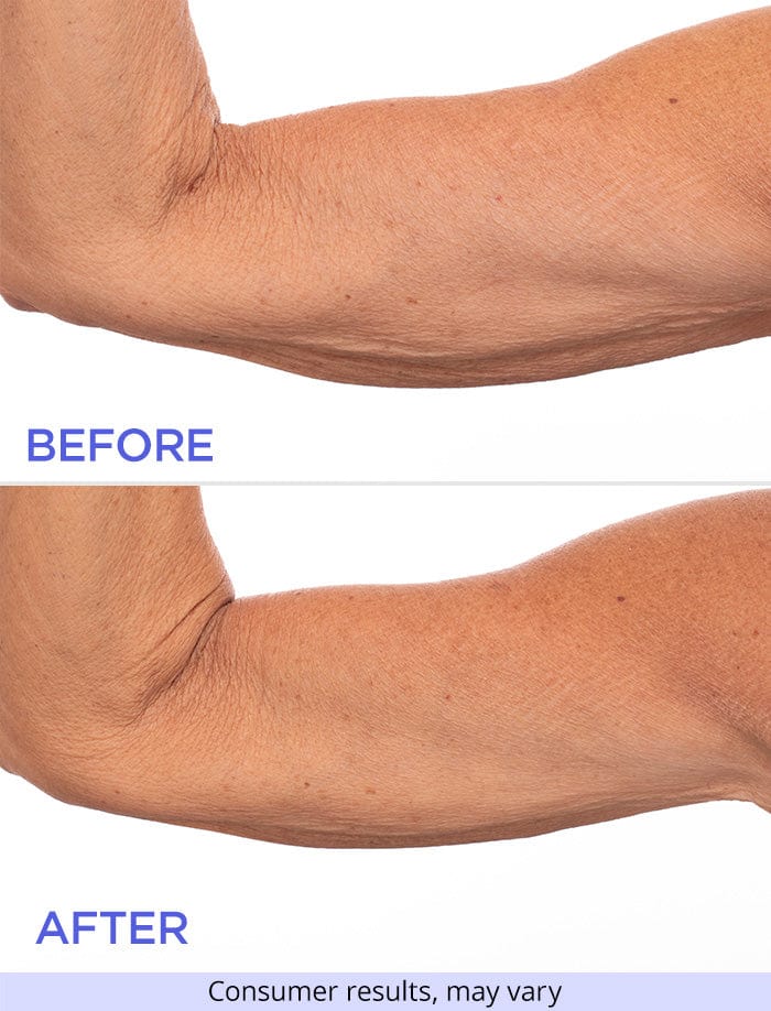Sculpt & Lift Duo
