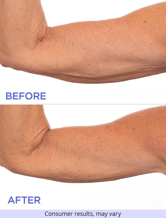Sculpt & Lift Duo